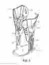 Fig. 09 - ANKLE BRACE