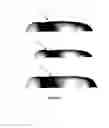 Fig. 03 - UPPER TORSO PROTECTIVE ORTHOTIC DEVICES AND USES THEREOF