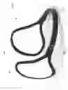 Fig. 02 - EAR WARMER FRAME