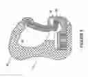 Fig. 05 - Connection tool for use with patient carrying systems