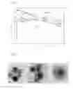 Fig. 02 - Nanoparticle-containing irrigation solution for endodontics