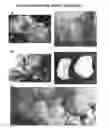 Fig. 01 - Joint repair using mesenchymal stem cells