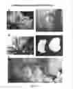 Fig. 02 - Joint repair using mesenchymal stem cells