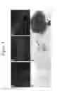 Fig. 05 - Joint repair using mesenchymal stem cells