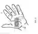Fig. 05 - Expandable amnion membrane for treating non-healing wounds
