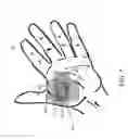 Fig. 06 - Expandable amnion membrane for treating non-healing wounds