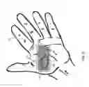 Fig. 07 - Expandable amnion membrane for treating non-healing wounds
