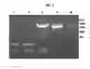 Fig. 02 - Extracellular vesicles comprising recombinant lysosomal transmembrane protein