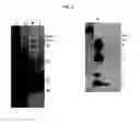 Fig. 03 - Extracellular vesicles comprising recombinant lysosomal transmembrane protein
