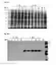 Fig. 04 - Extracellular vesicles comprising recombinant lysosomal transmembrane protein