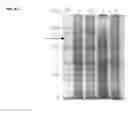 Fig. 06 - Extracellular vesicles comprising recombinant lysosomal transmembrane protein