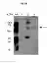 Fig. 07 - Extracellular vesicles comprising recombinant lysosomal transmembrane protein