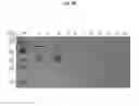 Fig. 09 - Extracellular vesicles comprising recombinant lysosomal transmembrane protein