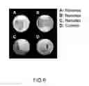 Fig. 07 - Superparamagnetic nanoparticles as a contrast agent for magnetic resonance imaging (MRI) of magnetic susceptibility (T2*)