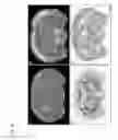 Fig. 09 - CARBAMATE COMPOUNDS AND METHODS OF USE IN DISEASES OF THE NERVOUS SYSTEM