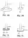 Fig. 09 - Leak correction for a patient interface device