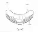 Fig. 81 - Cushion to frame assembly mechanism