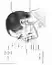 Fig. 08 - Patient interface