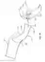 Fig. 55 - Patient interface