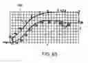 Fig. 58 - Patient interface