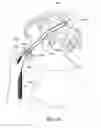 Fig. 79 - Patient interface
