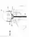 Fig. 86 - Patient interface