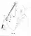 Fig. 87 - Patient interface