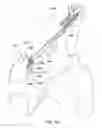 Fig. 89 - Patient interface
