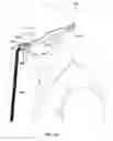 Fig. 92 - Patient interface