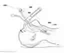 Fig. 01 - Endotracheal tube connector positioning system and method