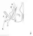 Fig. 02 - Endotracheal tube connector positioning system and method