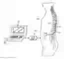 Fig. 01 - System and method for delivering modulated sub-threshold therapy to a patient