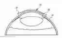 Fig. 01 - SYSTEM AND METHOD FOR THERAPEUTIC MANAGEMENT OF OCULAR HYPERTENSION
