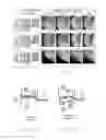 Fig. 04 - Deep-drawing method and forming die therefor