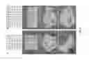 Fig. 08 - Apparatus, systems, and methods for modular soft robots