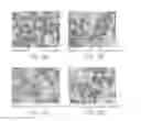 Fig. 07 - Methods of Treating Pediatric Acute Lymphoblastic Leukemia with an Anti-CD22 Immunotoxin