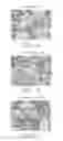 Fig. 09 - Methods of Treating Pediatric Acute Lymphoblastic Leukemia with an Anti-CD22 Immunotoxin