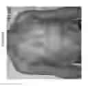 Fig. 31 - METHODS FOR DETECTION AND DIAGNOSIS OF A LYMPHOID MALIGNANCY USING HIGH THROUGHPUT SEQUENCING