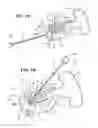 Fig. 02 - Lock release apparatus