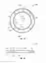 Fig. 02 - Downhole tool retainer and guide ring