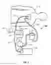 Fig. 02 - Pressure differential relief valve