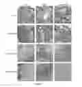 Fig. 12 - Methods for detecting human papillomavirus and providing prognosis for head and neck squamous cell carcinoma