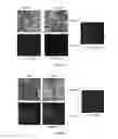 Fig. 13 - Methods for detecting human papillomavirus and providing prognosis for head and neck squamous cell carcinoma