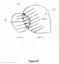 Fig. 22 - Preventing interference between tooth models