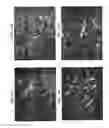 Fig. 09 - IMAGE PROCESSING METHODS AND SYSTEMS FOR FIBER ORIENTATION