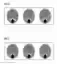 Fig. 06 - Iterative reconstruction of image data in CT