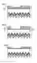 Fig. 04 - PHOTOELECTRIC CONVERSION ELEMENT AND METHOD OF MANUFACTURING PHOTOELECTRIC CONVERSION ELEMENT