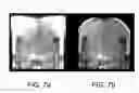 Fig. 08 - Device and method for obtaining densitometric images of objects by a combination of radiological systems and depth-sensing cameras