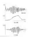 Fig. 09 - Directional filtering of audible signals