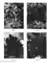 Fig. 03 - Avocado tree named 'LALI'